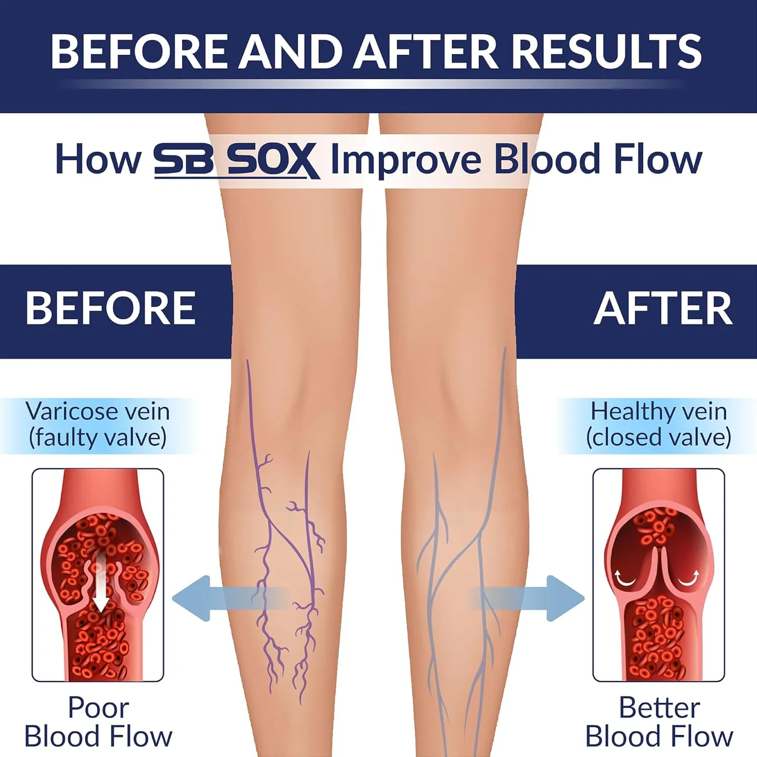SB SOX Compression Socks for Men & Women (20-30 mmHg) - Best Support Stockings for Travel, Medical, and Sports - Perfect for Everyday Wear